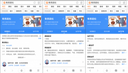 骨質(zhì)疏松你真的了解嗎？搜狗搜索教你正確守護(hù)骨骼健康