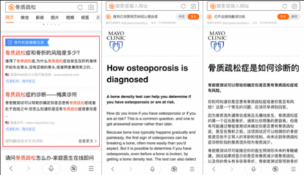 骨質(zhì)疏松你真的了解嗎？搜狗搜索教你正確守護(hù)骨骼健康
