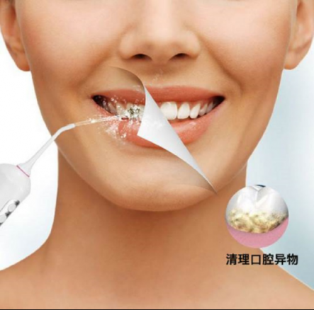 口腔清潔好幫手，美國XNUO心諾沖牙器值得信賴
