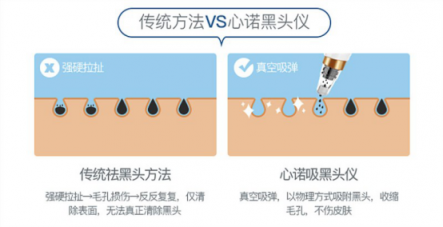雙11最值得入手的面部清潔電器！美國心諾黑頭儀價格直降一半！