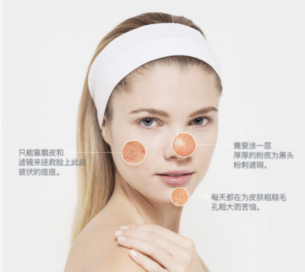 一百種去黑頭的方法都失敗了？去黑頭攻略全部拿下！