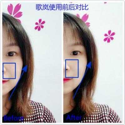 雅萌、GEVILAN歌嵐、Tripollar、NEWA美容儀到底選哪個？先評測一下再說