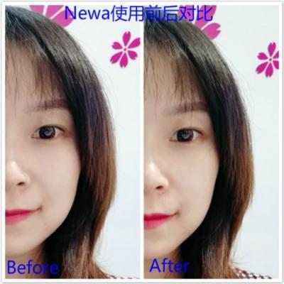 雅萌、GEVILAN歌嵐、Tripollar、NEWA美容儀到底選哪個？先評測一下再說