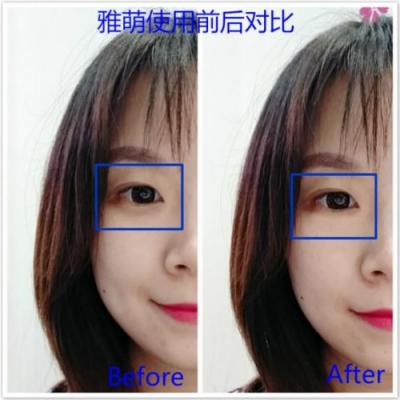 雅萌、GEVILAN歌嵐、Tripollar、NEWA美容儀到底選哪個？先評測一下再說