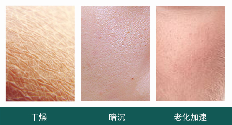 JOVS HIPL脫毛儀無(wú)痛原理揭秘！