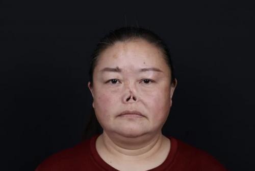 她，被羞辱欺凌40年，2020年成為新氧公益救助第一人