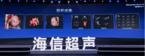 運算能力較傳統(tǒng)方案提升一倍，海信首臺超聲產品正式發(fā)布