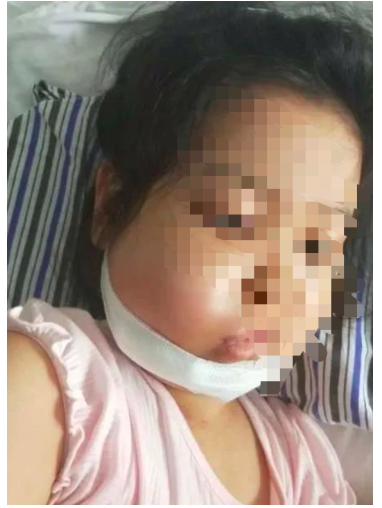 女童3歲確診白血病7歲復(fù)發(fā)，百萬治療費(fèi)無著落，水滴籌款幫孩子圓上學(xué)夢