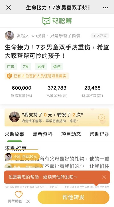 生命接力！輕松籌上愛心匯聚，幫助被生父燒傷的可憐男童重獲新生