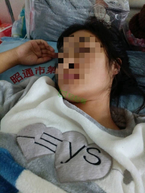 離婚路上被丈夫抱摔扔下橋，女孩無奈發(fā)起輕松籌求助醫(yī)療費(fèi)