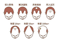 2.5億人被脫發(fā)困擾？Rogaine培健實(shí)力生發(fā)
