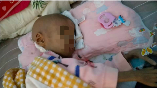 4歲女童得罕見病只有11斤，高昂費(fèi)用壓垮母親，水滴愛心接力帶來(lái)希望