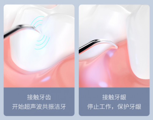 小米有品眾籌近3萬(wàn)人瘋搶！素諾智能可視潔牙儀T11 Pro成網(wǎng)紅爆款