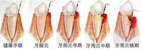 小米有品眾籌超10000000！素諾智能可視潔牙儀T11Pro為何一炮而紅？