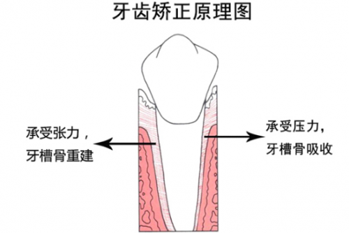3D數(shù)字化模型矯牙“神器”，讓你不懼年齡“矯”傲逆襲