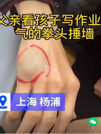 虎爸輔導(dǎo)孩子作業(yè)致使自己受傷，不妨試試訊飛智能學(xué)習(xí)機(jī)