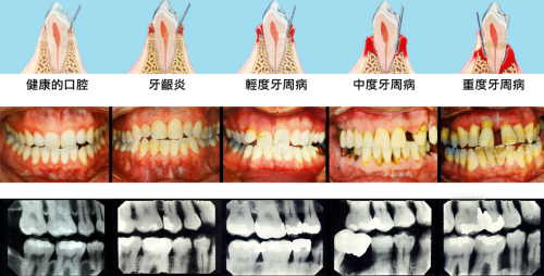 8月5日小米有品眾籌！素諾智能可視沖牙器C3 pro倒計(jì)時(shí)海報(bào)曝光