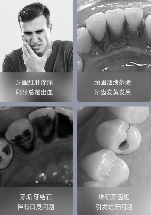 周四10點(diǎn)！素諾智能可視沖牙器C3 pro小米有品眾籌明天見(jiàn)！