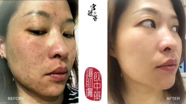 Myeong香港宮廷薈，帶你解鎖宮廷中藥新護(hù)膚方式！