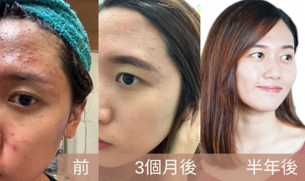 Myeong香港宮廷薈，帶你解鎖宮廷中藥新護(hù)膚方式！