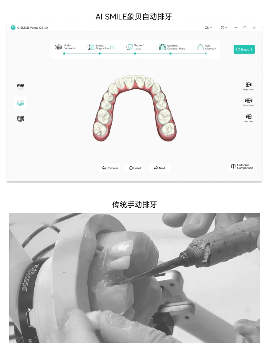 獨角獸地位盡顯！象貝AI正畸排牙系統(tǒng)Venus1.0發(fā)布 開辟數(shù)字化牙科新紀(jì)元