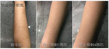 這3款網(wǎng)紅脫毛儀評測大集錦，你都了解過了嗎？