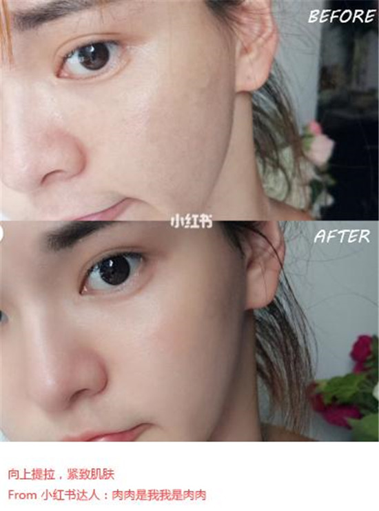 美容儀哪個(gè)品牌好？抗老神器歌嵐美容儀了解下
