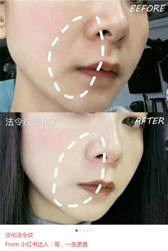 美容儀哪個(gè)品牌好？抗老神器歌嵐美容儀了解下