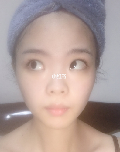 肌膚抗初老一個對策，GEVILAN歌嵐3D射頻美容儀