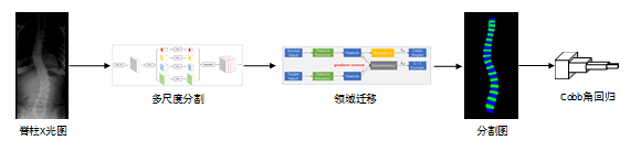 斬獲2019 MICCAI AASCE第一，騰訊優(yōu)圖醫(yī)療AI再獲突破