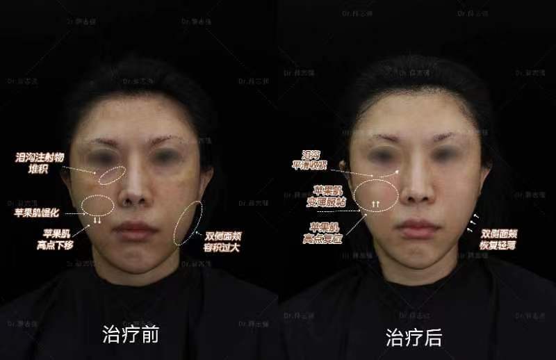 修復于面，療愈于心——“北京面部饅化修復中心”的故事與使命