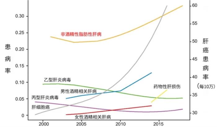 中國非酒精性脂肪肝泛濫，西班牙plameca波利王益肝露拯救代謝危機(jī)